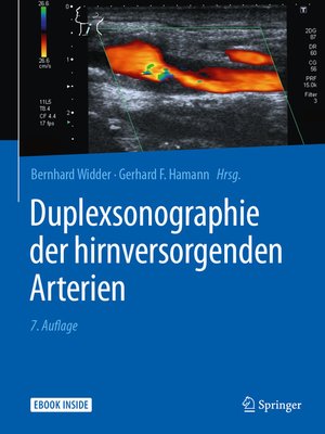 cover image of Duplexsonographie der hirnversorgenden Arterien